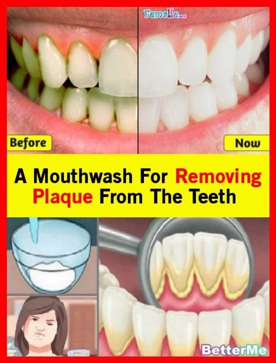A Mouthwash To Take Off The Teeth Plaque Mouthwash Plaque Teeth How To Remove