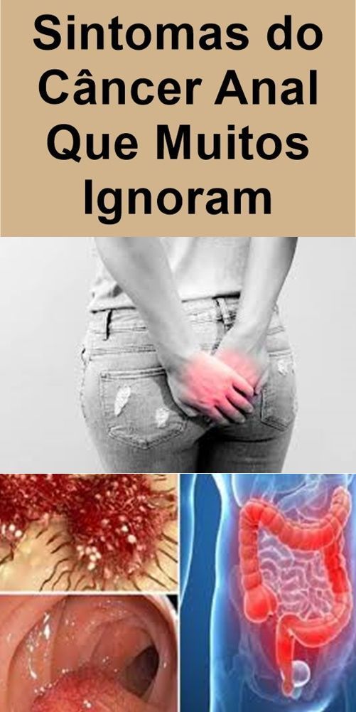 Lesbicas gostosas se chupando em video caseiro Sitomas do cancer anal