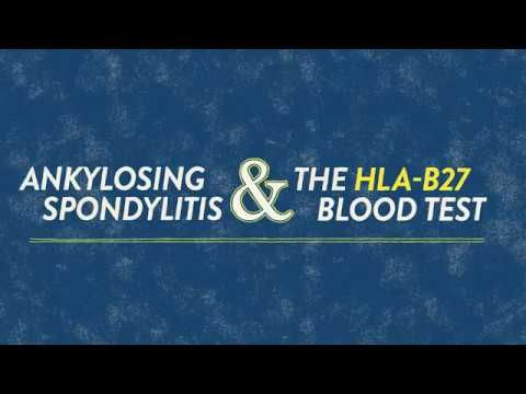 Pin On Blood Tests