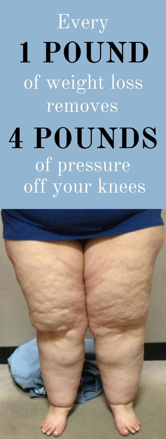 Tips to lose weight from stomach photo 8