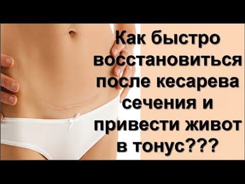 Убрать живот после кесарева упражнения