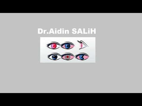 Goz Hastaliklari Hangi Organlarin Islevlerinin Bozulmasiyla Ortaya Cikar Dr Aidin Salih Youtube Youtube Dogal Tedaviler Gozler Goz Hastaliklari Hangi Organlarin Islevlerinin Bozulmasiyla Ortaya Cikar Dr Aidin Salih Youtube Youtube Dogal Tedaviler Gozler