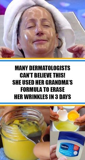 DERMATOLOGISTS CAN’T BELIEVE THIS SHE USED HER GRANDMAS FORMULA TO ERASE HER WRINKLES IN 3 DAYS - She Made by Grace