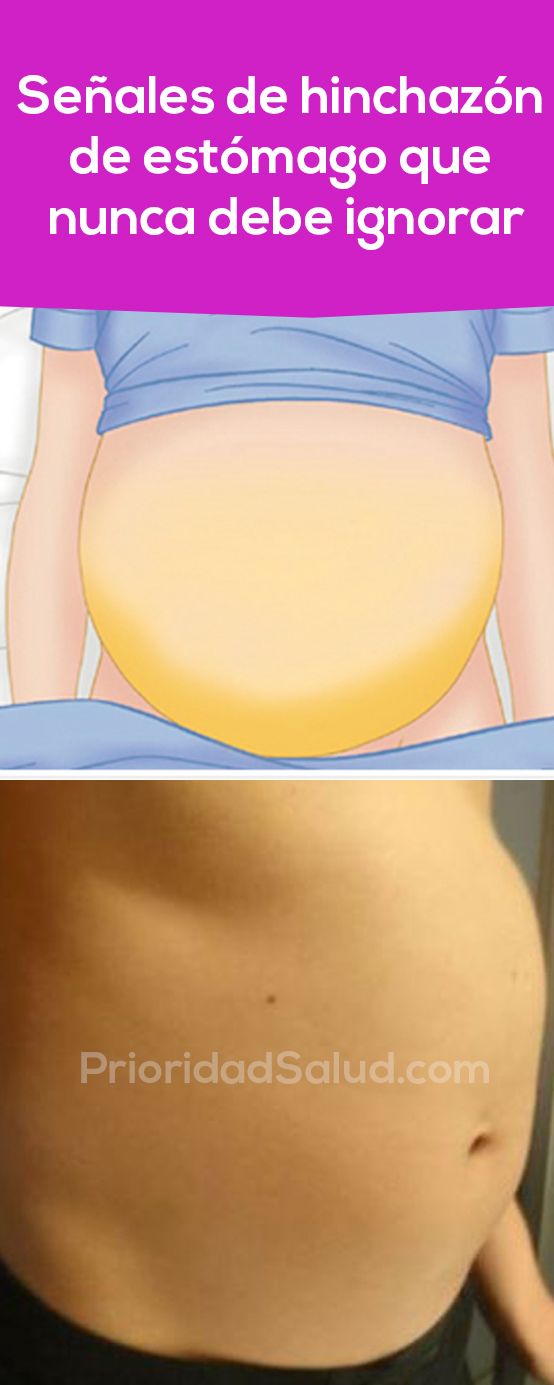 dolor+en+el+estomago+y+vientre+inflamado