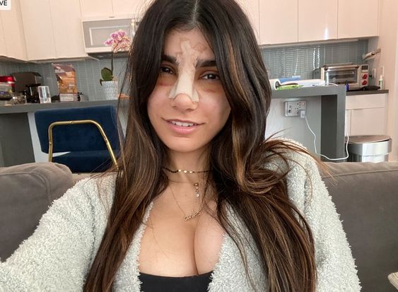 Mia Khalifa Gets $15,000 Nose Job, See The Results