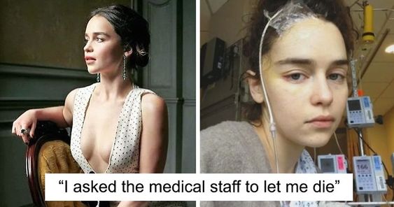 Emilia Clarke Shares 5 Never-Before-Seen Photos From Hospital After Having Two Aneurysms | Bored Panda