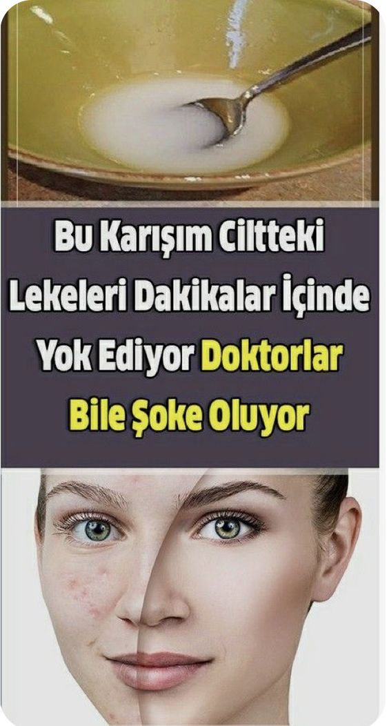 Onka Garaj Adli Kullanicinin Guzellik Panosundaki Pin 2021 Ev Yapimi Cilt Bakimi Cilt Rengi Dogal Cilt Onka Garaj Adli Kullanicinin Guzellik Panosundaki Pin 2021 Ev Yapimi Cilt Bakimi Cilt Rengi Dogal Cilt
