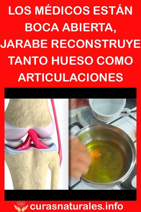 Los Médicos Están Boca Abierta Jarabe Reconstruye Tanto Hueso Como Articulaciones Médicos Jarabe Remedios Remedios Naturales Remedios Naturales Para La Tos