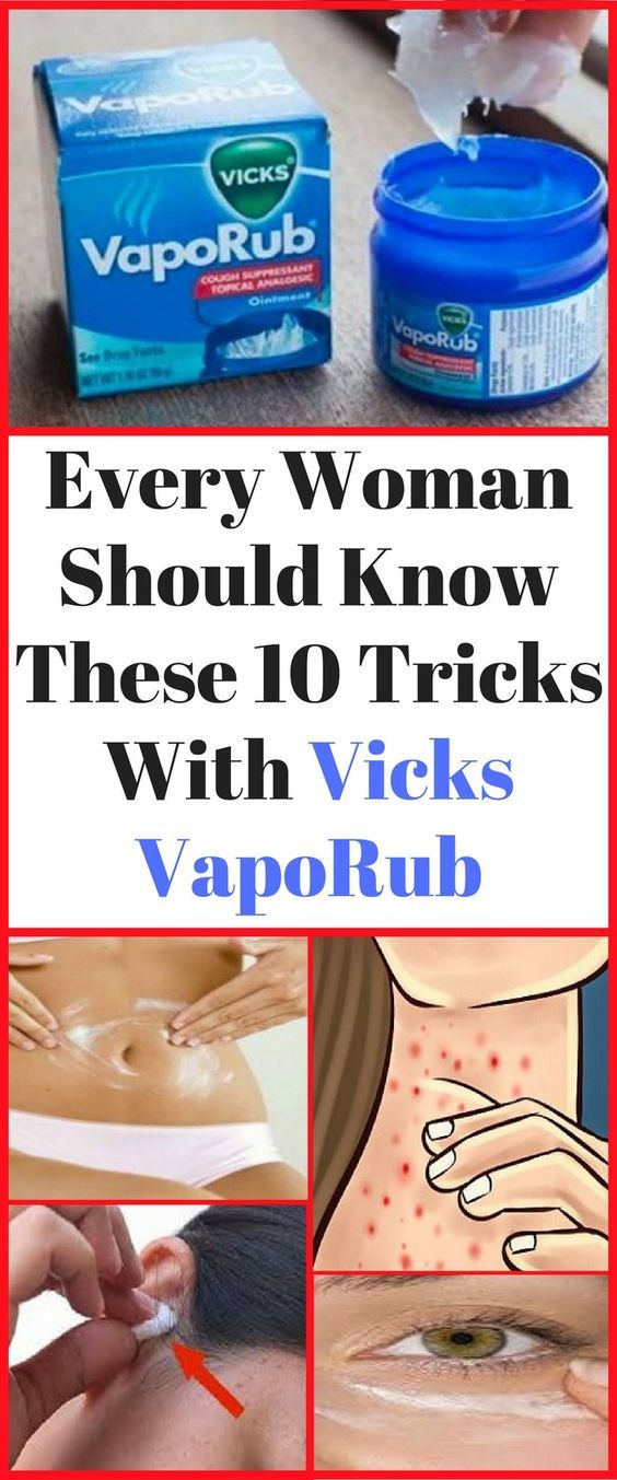 Verwendung von Vick Vaporub zur Gewichtsreduktion Verwendung von Vick Vaporub zur Gewichtsreduktion
