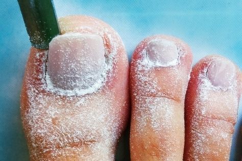 Increíble El Aceite De Ricino Y Bicarbonato De Sodio Pueden Tratar Más De 21 Problemas De Salud Hoy Aprendí S Aceite De Ricino Remedios Bicarbonato De Sodio