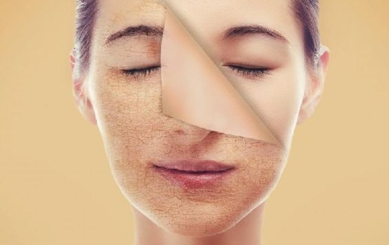 Tẩy tế bào chết giúp chúng lão hóa da