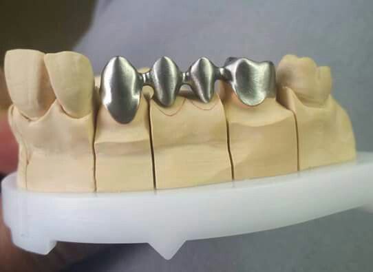 Pin De Jean Pierre Valdivia Rosales En çalışmaörneklerimetalaltyapıörneğibydrbigboss Protesis Dental Fija Tecnico Dental Laboratorio Dental