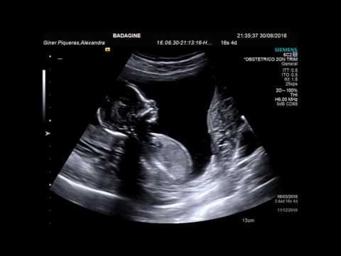 Ecografia 15 Semanas Es Un Chico Ecografias Embarazo Ultrasonido De Embarazo 15 Semanas De Embarazo
