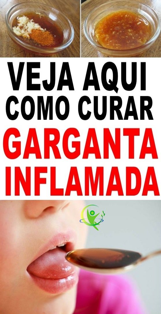 Remedios garganta inflamada e irritada