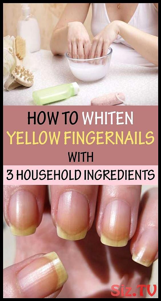 Here S A Home Remedy For Clean White Nails That Really Works My Nails Are Beautiful White Nails Toe Nails Health And Beauty Tips