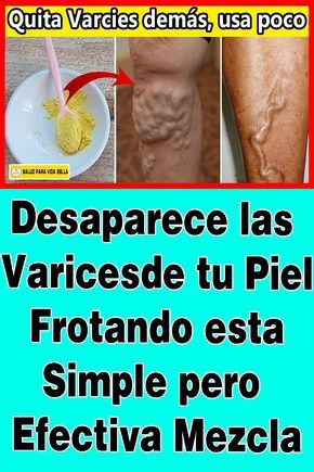 Pin En Medicamentos Caseros