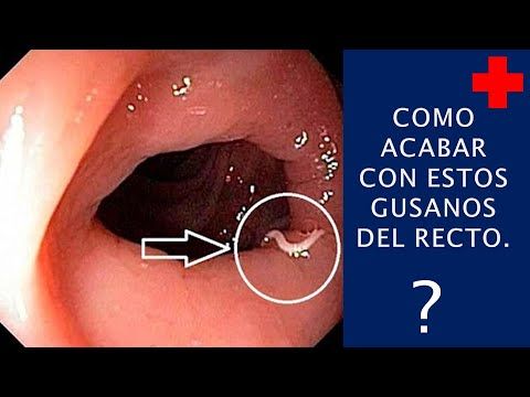 como eliminar el oxiuros de forma natural