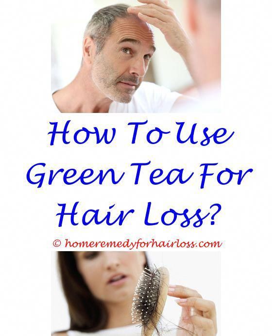 Pin On Hair Loss Stinks