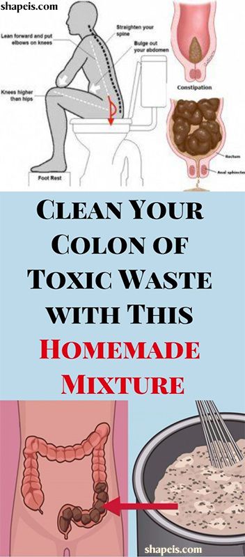 detox colon curata acasa