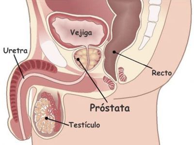 no tener relaciones sexuales debido a la próstata agrandada