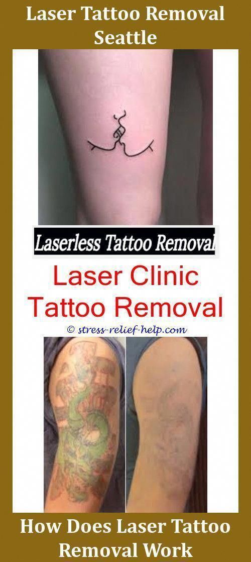 Tattoo Removal Cream How To Use TATOFG