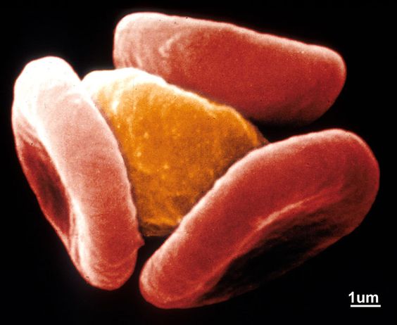 Scientists find Achilles\' heel in life-threatening malaria parasites http://www.ed.ac.uk/schools-departments/biology/news-events/archive?id=252_xml=public_archive.php