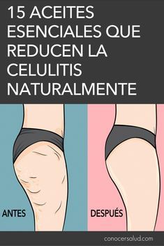 15 Aceites Esenciales Que Reducen La Celulitis Naturalmente Conocer Salud Coconut Hair Treatment Hair Treatment Beauty Solution