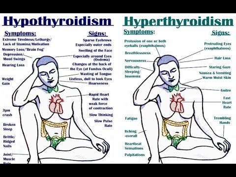 How To Do Hypopressive Exercises 7 Steps With Images Exercise Pelvic Floor Exercises Floor Workouts