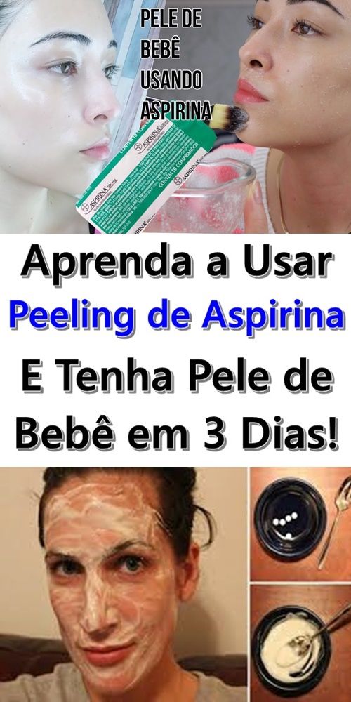 De aspirina do bebê varizes