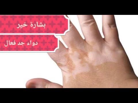رجيم سريع في رمضان Ramadan Diet Health Fitness Nutrition Health Facts Food