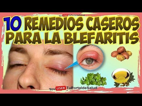 tipos de blefaritis fotos diabetes
