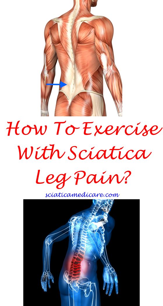 Can Prednisone Help Piriformis Syndrome Can Prednisone Help Piriformis Syndrome