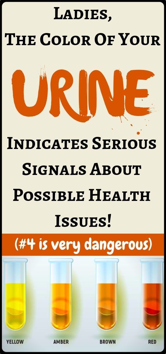 What the color of your urine and frequent urination can tell you about your he… | Health and fitness tips, Natural headache remedies, Natural remedies for allergies What the color of your urine and frequent urination can tell you about your he… | Health and fitness tips, Natural headache remedies, Natural remedies for allergies