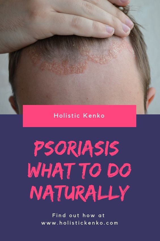 psoriasis is an inflammatory skin condition