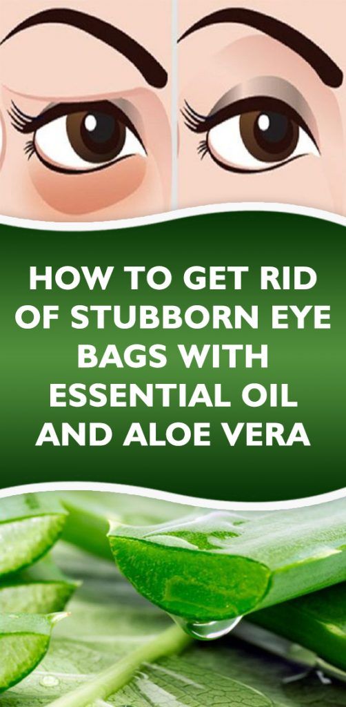 How To Get Rid Of Stubborn Eye Bags With Essential Oil And Aloe Vera