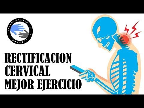 artrosis cervical ejercicios prohibidos artrosis cervical ejercicios prohibidos