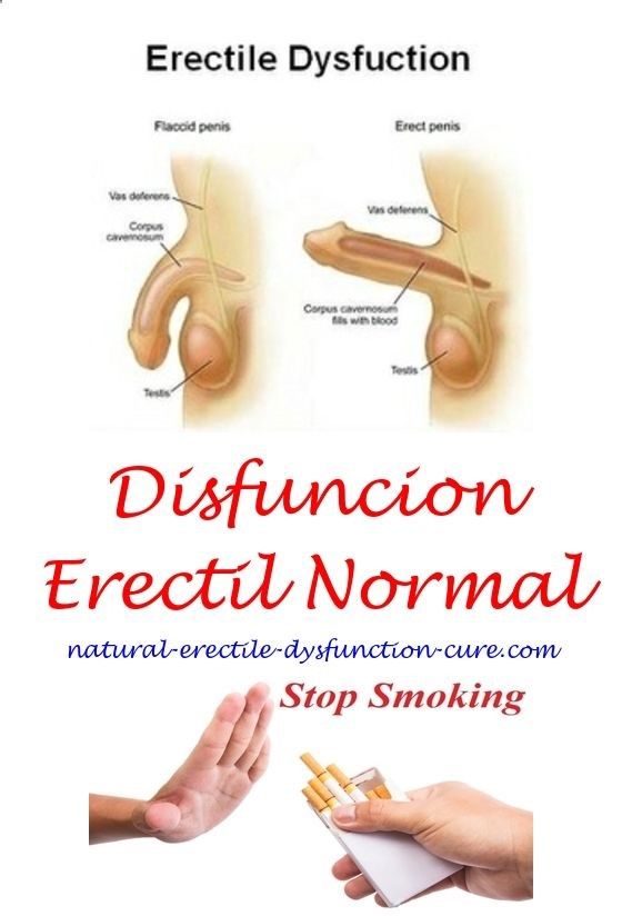 Suplementos Para La Disfunción Eréctil Disfuncion Erectil Novio Homeopatia Para La Disfuncion Erectil Ejercicios P Erectile Dysfunction Can Opener Stop Smoke