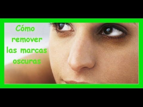 Como Eliminar Las Manchas Oscuras De Los Ojos Youtube Manchas Oscuras Manchas Ojos