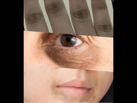 ماسك للبقع السوداء حول الفم والاصابع والهالات السودا وتصبغات الجلد Youtube Arabic Food Food And Drink