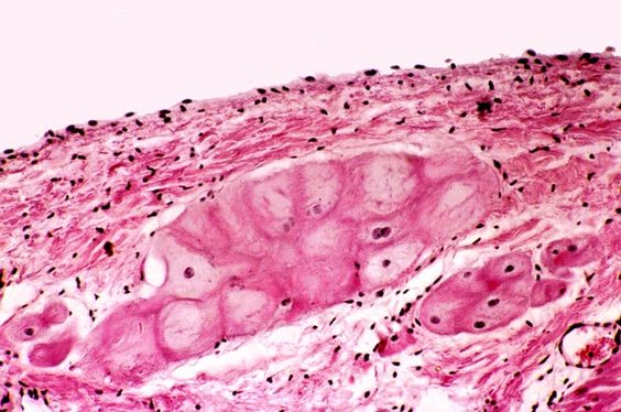 Purkinje Fibers Cardiovascular System Fiber Body