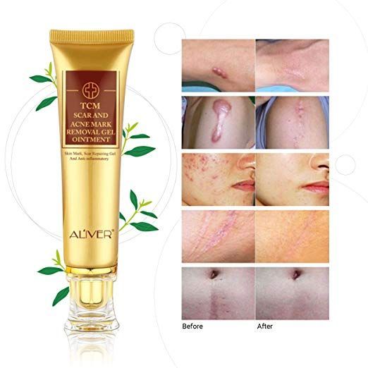 Miracalis Stretch Mark Cream Scar Blemish Removal And