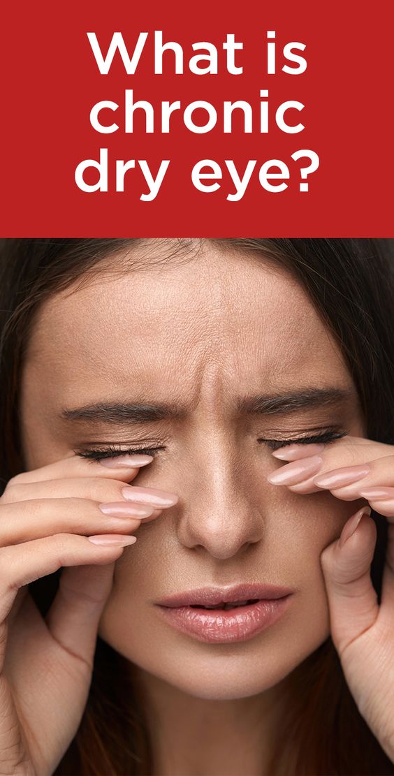 What Is Chronic Dry Eye Chronic Dry Eye Dry Eye Symptoms Dry Eyes