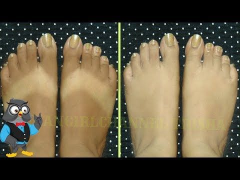 Como quitar manchas del sol en los brazos Como quitar manchas del sol en los brazos