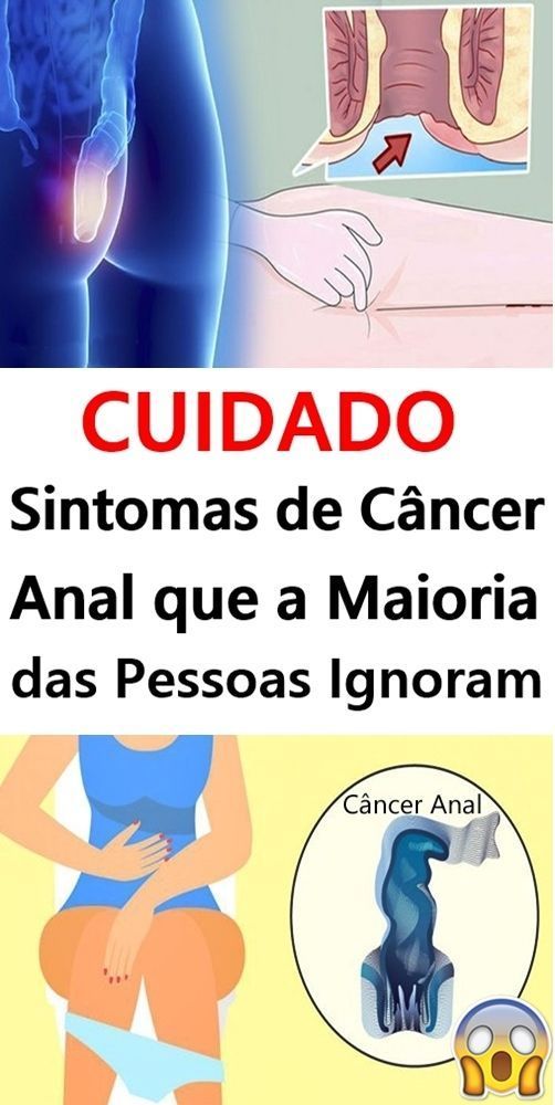 Traindo gostosas porno carioca Sitomas do cancer anal