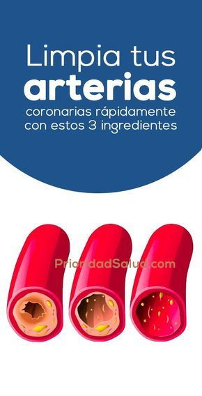 arterias bloqueadas y ed