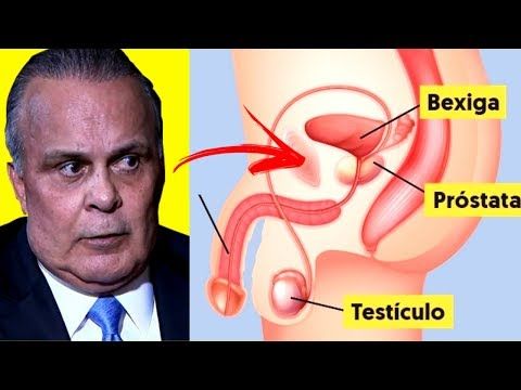 qual o melhor remedio caseiro para prostata aumentada