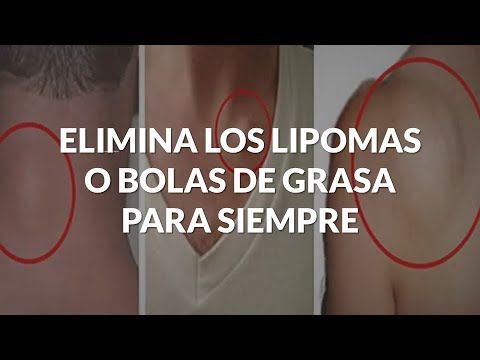 Elimina Los Lipomas O Bolas De Grasa De Forma Definitiva Health Health Fitness Contour Makeup