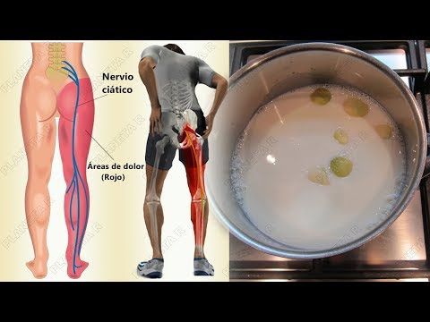 Como Desbloquear El Nervio Ciático 2 Formas Faciles De Eliminar Todo El Dolor Youtube Dolor De Los Nervios Dolor De Ciatica Nervio Ciatico