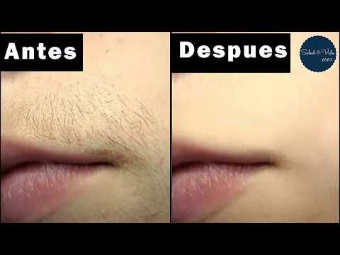 Elimina El Vello En 5 Minutos Para Siempre Aprende Cómo No Mas Vello No Deseado Youtube Como Eliminar Vello Depilación Casera Tips De Belleza Caseros