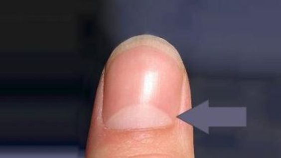 معنى تواجد الهلال الأبيض على الأظافر White Spots On Fingernails Fingernails Inspiration